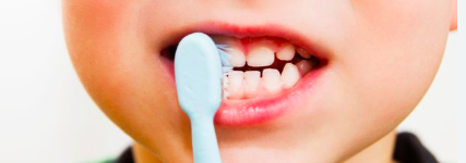 Healthy Kids teeth by growing smiles dentistry