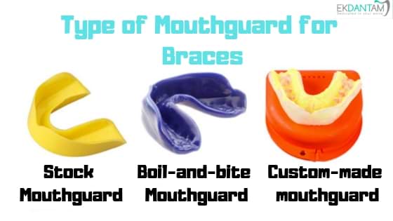 Types of mouthguards