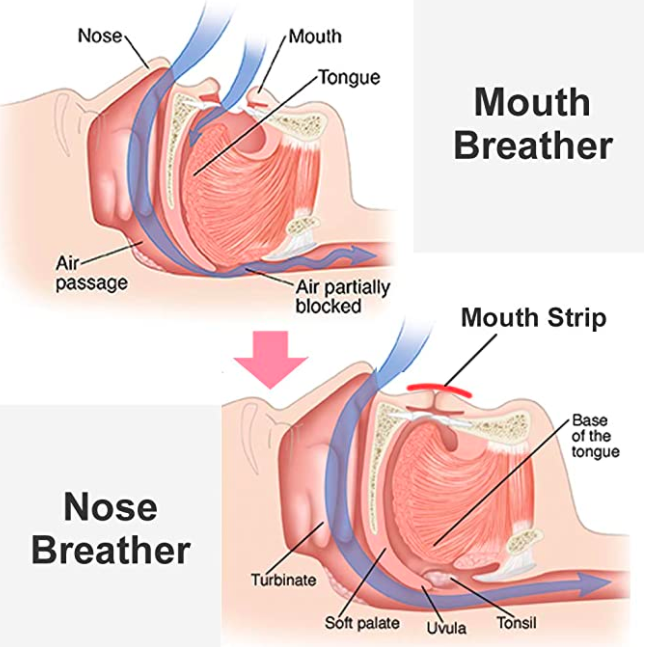 Main Causes of Mouth Breathing